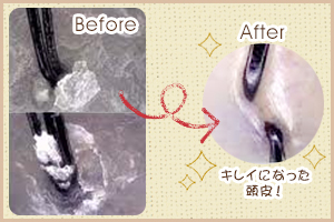 ヘッドスパ before after